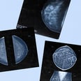 Are AI-Assisted Mammograms the Future? Here's What to Know